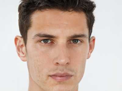 济南市男生乳头缩小医生排行top10榜单分享-徐静静医生都是实力派